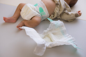 Changing the diaper of the newborn baby