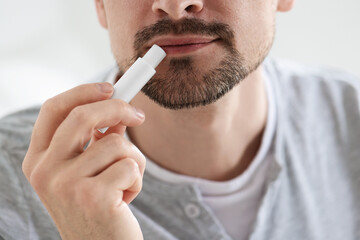 Man applying lip balm onto his lips on blurred light background, closeup