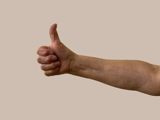 Female hand with sore fingers and raised thumb on light background