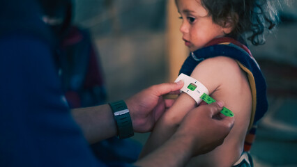 A doctor examines children's malnutrition inside a refugee camp. Malnutrition was measured using a...