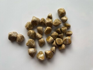 stones extracted from a human gallbladder