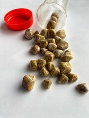 stones extracted from a human gallbladder