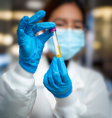 Close up of a lab technician's gloved hands holding a test tube filled with yellow liquid. The...