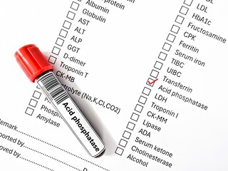 Blood sample tube and paper order request for alkaline phosphatase (ALP) test analysis.