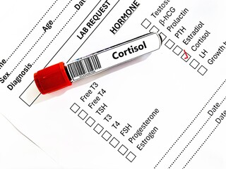 Blood sample tube and paper order request for cortisol test analysis.