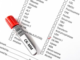Blood sample tube and paper order request for CK-MM test analysis.