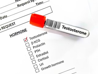 Blood sample tube and paper order request for testosterone test analysis.