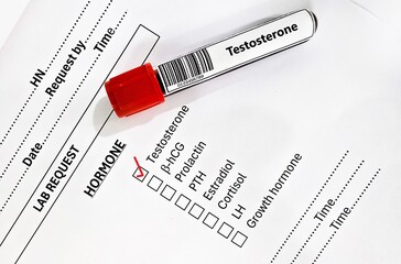 Blood sample tube and paper order request for testosterone test analysis.