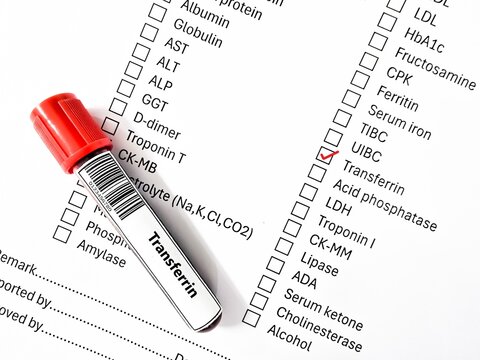 Blood sample tube and paper order request for transferrin test analysis.