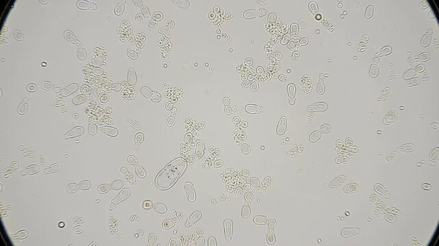 Microscopic view of yeast cells, some budding, against a light background