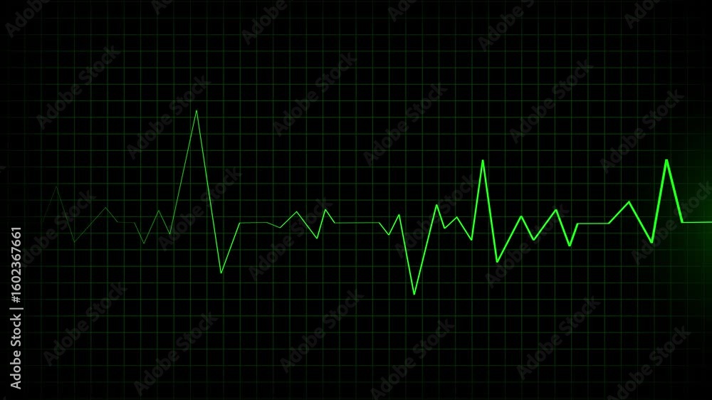 Poster animated heartbeat line graph. medical pulse rate data visualization technology abstract background.