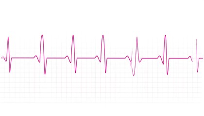 Pink EKG rhythm strip on gridded background