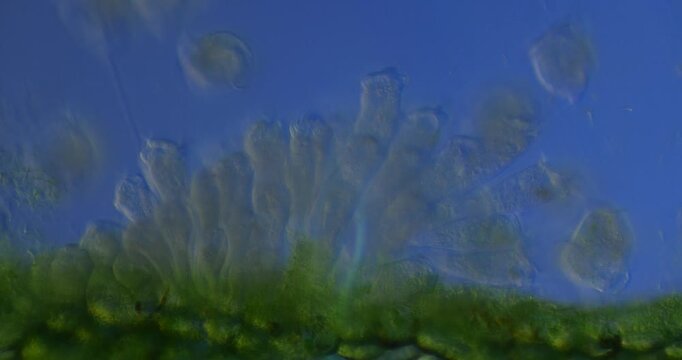 Colony of Vorticella protozoa filter feeding under 400x magnification with visible ciliary currents and rhythmic stalk contractions