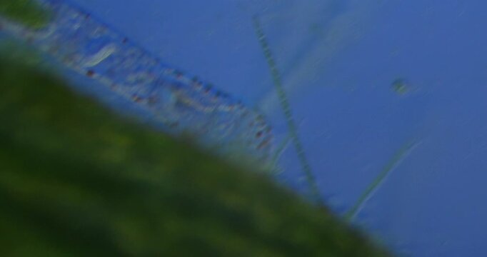 Naididae oligochaete worm locomotion at 100x magnification in aquatic microecosystem