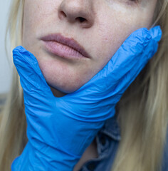 A dermatologist examines a woman's face with dilated pores, pigmentation, and sebaceous filaments....