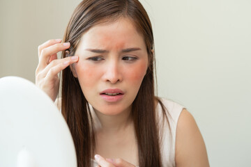 Dermatology, puberty asian young woman, girl looking into mirror, allergy presenting an allergic...