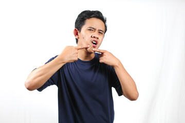 Asian man pressing pimple on chin showing pained facial expression, isolated on white background