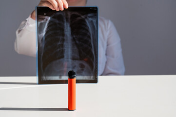 Doctor holding x-ray of lungs with vape in background. 