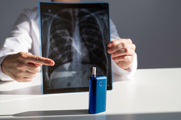 Doctor holding x-ray of lungs with e-cigarette in background. 
