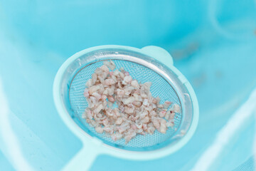 Straining small tissue from removed prostate gland from bladder after medical procedure