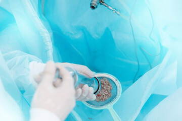 Laparoscopic surgery, removal of prostate remnants after laser surgery