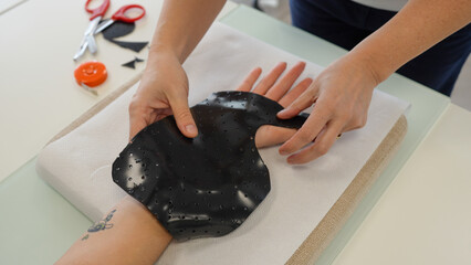 Medical therapist adjusting a hand splint for a girl in a rehabilitation clinic
