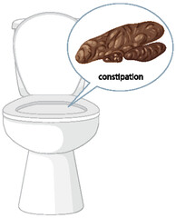 Constipation Illustration with Toilet and Stool Graphic