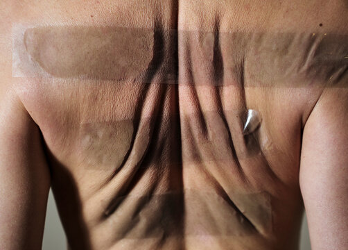 Rear view of human back with wrinkles and adhesive tape showing body positivity