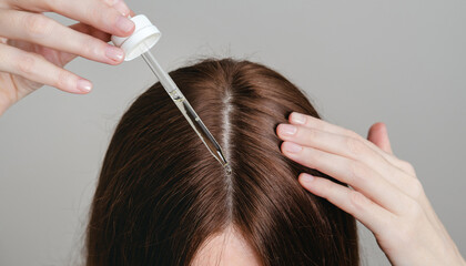 Woman applies cosmetic oil to scalp to strengthen and grow hair. Health care, beauty treatment, hair loss problem.Treatment for hair loss due to stress and depression