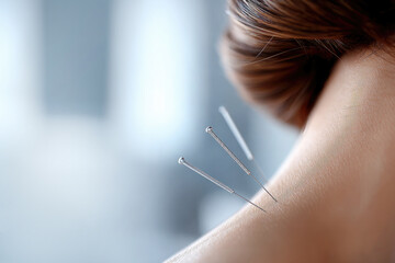 Traditional Chinese Acupuncture Treatment for Stress Relief, Close Up of Needles, Holistic Healing Concept, Wellness and Energy Healing, Alternative Medicine
