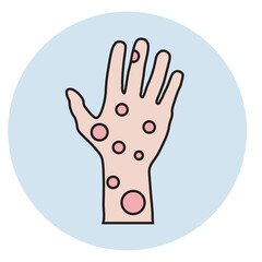 hand icon Atopic eczema vector illustration showing itchy, red, scaly skin; includes symptoms like dryness and swelling. Highlights similar diseases: psoriasis, contact dermatitis.