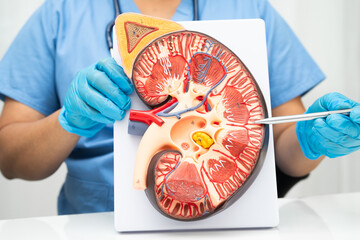 Chronic kidney disease, doctor with model for treatment urinary system, urology, Estimated...