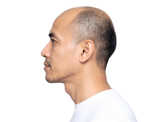 Portrait of a bald man head side view, isolated on transparent background.