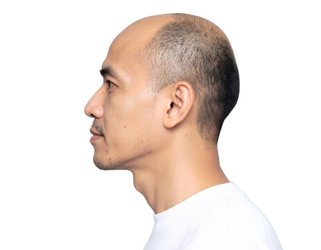 Portrait of a bald man head side view, isolated on transparent background.