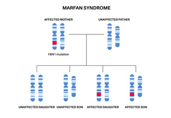Marfan syndrome poster
