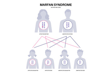 Marfan syndrome poster