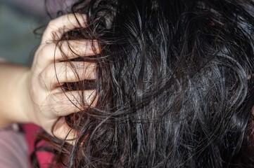 Close-up view of a person's dark hair, potentially affected by dandruff or a scalp issue.