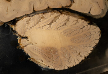 Human Brain Section Showing Arbor Vitae in Cerebellum