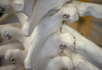 Rib and Vertebra With Demifacet Joint on Human Skeleton