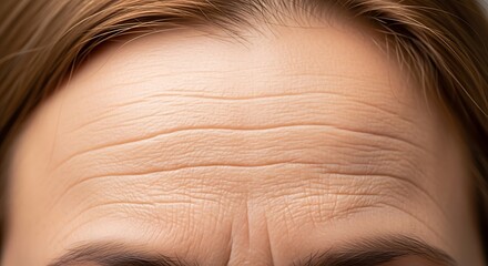 Forehead wrinkles on a person's skin.