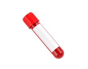 Blood sample in a test tube with a red cap ready for medical analysis and scientific research.