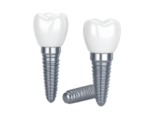 Dental implants showcase modern restorative dentistry for a healthy and confident smile.