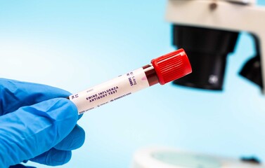 Identifies antibodies to swine influenza viruses, indicating