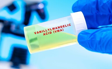 Assesses levels of VMA in urine to evaluate catecholamine