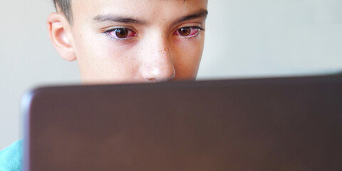irritated eyes of teenage boy while using his laptop in deep concentration