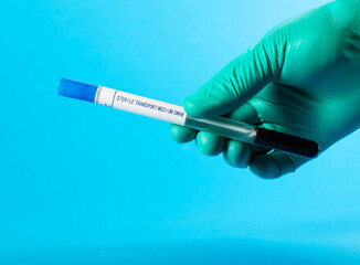 A reproductive doctor holds a test tube with sperm in his hand to determine the reproductive...