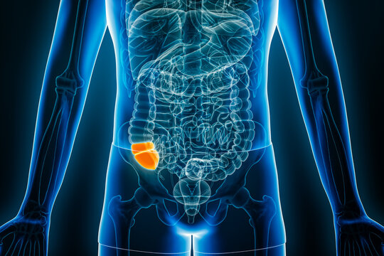 X-ray anterior or front view of the cecum, part of the human colon, 3D rendering illustration with body contours. Anatomy, organ of digestive system, medical, biology, science, healthcare concept.