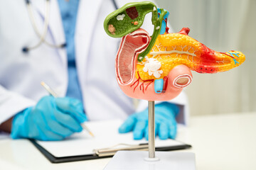 Pancreatitis, pancreatic cancer, Asian doctor with pancreas, gallbladder and bile duct human...