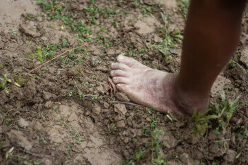 A man puts his leg on the ground green grass
