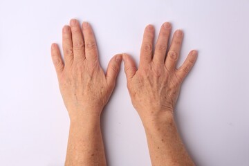Closeup view of woman's hands with aging skin, top view